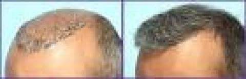 Stronger Roots Comparison